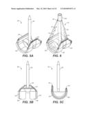 DEVICE AND METHOD FOR RECONSTRUCTION OF OSSEOUS SKELETAL DEFECTS diagram and image