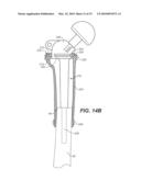 DEVICE AND METHOD FOR RECONSTRUCTION OF OSSEOUS SKELETAL DEFECTS diagram and image