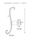 Linearly Expandable Ureteral Stent diagram and image