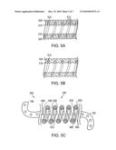 Linearly Expandable Ureteral Stent diagram and image