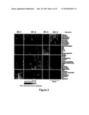 Diagnosis of Metastatic Melanoma and Monitoring Indicators of Immunosuppression Through Blood Leukocyte Microarray Analysis diagram and image