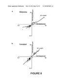 Diagnosis of Metastatic Melanoma and Monitoring Indicators of Immunosuppression Through Blood Leukocyte Microarray Analysis diagram and image