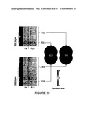 Diagnosis of Metastatic Melanoma and Monitoring Indicators of Immunosuppression Through Blood Leukocyte Microarray Analysis diagram and image