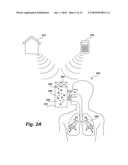 Method, composition, and system to control pH in pulmonary tissue of a subject diagram and image