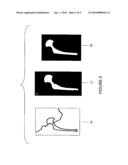 METHOD FOR IDENTIFYING IMPLANTED RECONSTRUCTIVE PROSTHETIC DEVICES diagram and image