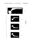 METHOD FOR IDENTIFYING IMPLANTED RECONSTRUCTIVE PROSTHETIC DEVICES diagram and image