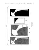 METHOD FOR IDENTIFYING IMPLANTED RECONSTRUCTIVE PROSTHETIC DEVICES diagram and image