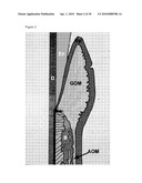 PLURIPOTENT AUTOLOGOUS STEM CELLS FROM ORAL MUCOSA AND METHODS OF USE diagram and image