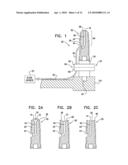 SINUS LIFT IMPLANT diagram and image