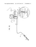 SINUS LIFT IMPLANT diagram and image