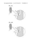 SINUS LIFT IMPLANT diagram and image