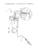 IMPLANTS, TOOLS, AND METHODS FOR SINUS LIFT AND LATERAL RIDGE AUGMENTATION diagram and image