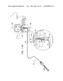 IMPLANTS, TOOLS, AND METHODS FOR SINUS LIFT AND LATERAL RIDGE AUGMENTATION diagram and image