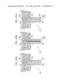 IMPLANTS, TOOLS, AND METHODS FOR SINUS LIFT AND LATERAL RIDGE AUGMENTATION diagram and image
