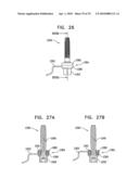 IMPLANTS, TOOLS, AND METHODS FOR SINUS LIFT AND LATERAL RIDGE AUGMENTATION diagram and image