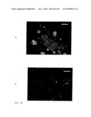 Devices and methods for analyte detection using distorted liquid crystals diagram and image