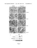BIOMARKERS FOR KIDNEY DISEASES AND METHOD FOR USING SAME diagram and image