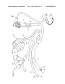 MEDICAL TREATMENT ENDOSCOPE diagram and image