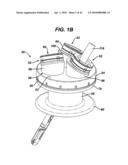 Surgical Access Device diagram and image