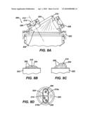 Surgical Access Device diagram and image