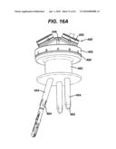 Surgical Access Device diagram and image