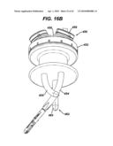 Surgical Access Device diagram and image