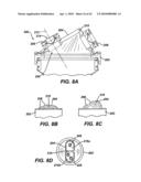 Surgical Access Device with Protective Element diagram and image