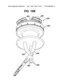 Surgical Access Device with Protective Element diagram and image