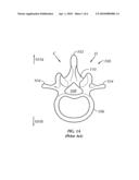 Working Channel for Minimally Invasive Spine Surgery diagram and image