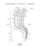 Working Channel for Minimally Invasive Spine Surgery diagram and image