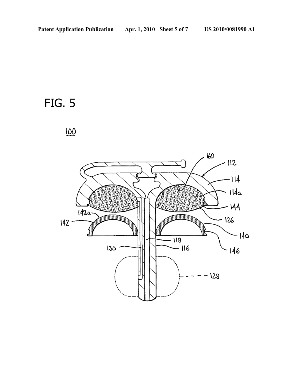 MEDICAL DEVICE HAVING PREFILLED BALLON - diagram, schematic, and image 06