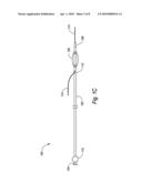 GUIDEWIRE REPLACEMENT DEVICE diagram and image