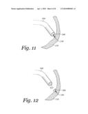 APPARATUS AND METHOD FOR DRIVING A HEMORRHAGE OCCLUDER PIN INTO A HUMAN SACRUM diagram and image