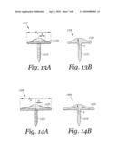 APPARATUS AND METHOD FOR DRIVING A HEMORRHAGE OCCLUDER PIN INTO A HUMAN SACRUM diagram and image