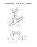 LINE VALVE diagram and image