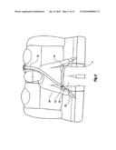 Seatbelt Restraint diagram and image