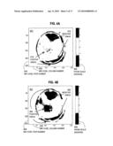 SPECTRAL RESOLUTION ENHANCEMENT OF MAGNETIC RESONANCE SPECTROSCOPIC IMAGING diagram and image