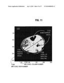 SPECTRAL RESOLUTION ENHANCEMENT OF MAGNETIC RESONANCE SPECTROSCOPIC IMAGING diagram and image