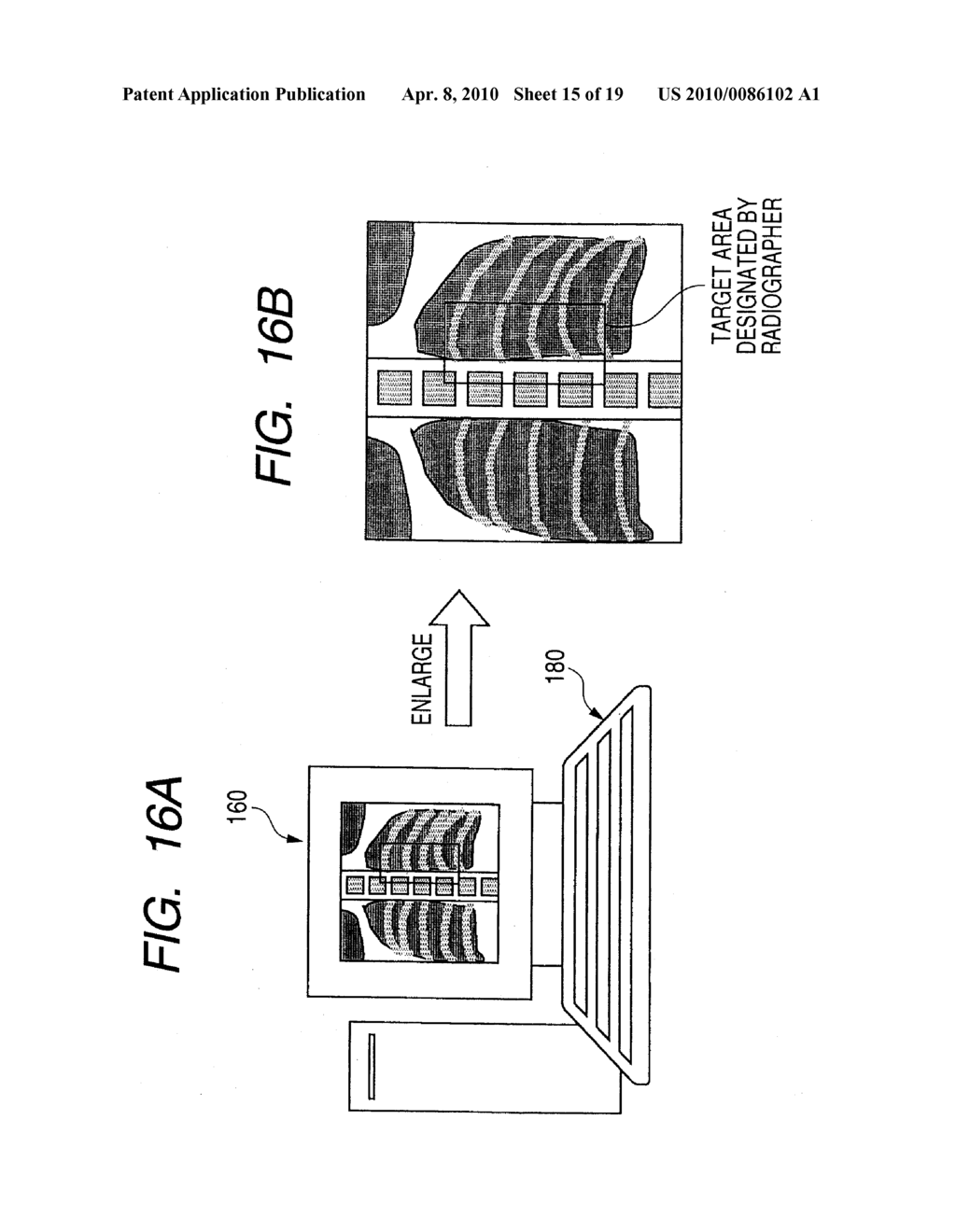 RADIATION IMAGING APPARATUS AND METHOD OF DRIVING THE SAME, AND RADIATION IMAGING SYSTEM - diagram, schematic, and image 16