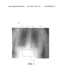 AUTOMATED QUANTIFICATION OF DIGITAL RADIOGRAPHIC IMAGE QUALITY diagram and image