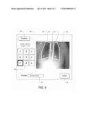 AUTOMATED QUANTIFICATION OF DIGITAL RADIOGRAPHIC IMAGE QUALITY diagram and image