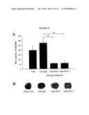 ANTICANCER AGENT COMPRISING ANTI-PD-1 ANTIBODY OR ANTI-PD-L1 ANTIBODY diagram and image