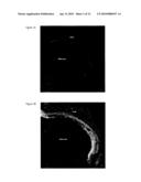 Pharmaceutical composition for tumor treatment diagram and image