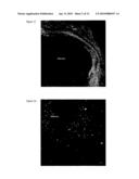 Pharmaceutical composition for tumor treatment diagram and image