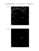 Pharmaceutical composition for tumor treatment diagram and image