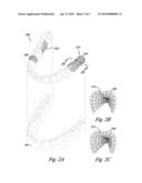 DENTAL POSITIONING APPLIANCE HAVING METALLIC PORTION diagram and image