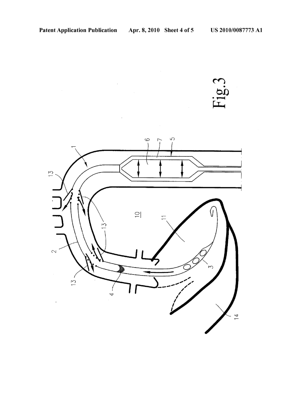 DEVICE FOR SUPPORTING THE HEART AND CIRCULATORY SYSTEM - diagram, schematic, and image 05