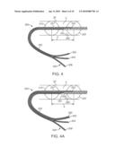 MINIMALLY INVASIVE METHODS FOR THERMAL TREATMENT diagram and image