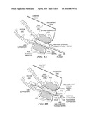 Method and apparatus for inserting a rectal suppository diagram and image