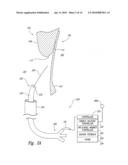 Systems and Methods for Controlling Patient Catheters diagram and image